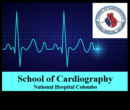 Higher Diploma in Cardiography-11 