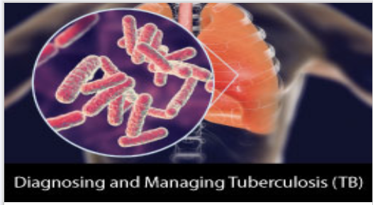 Diagnosing and Managing Tuberculosis (TB)